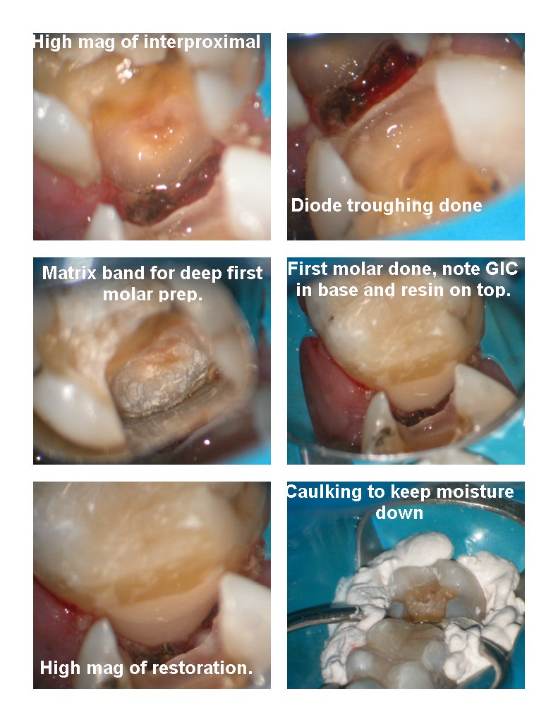 Deep Cavities pg 2.jpg